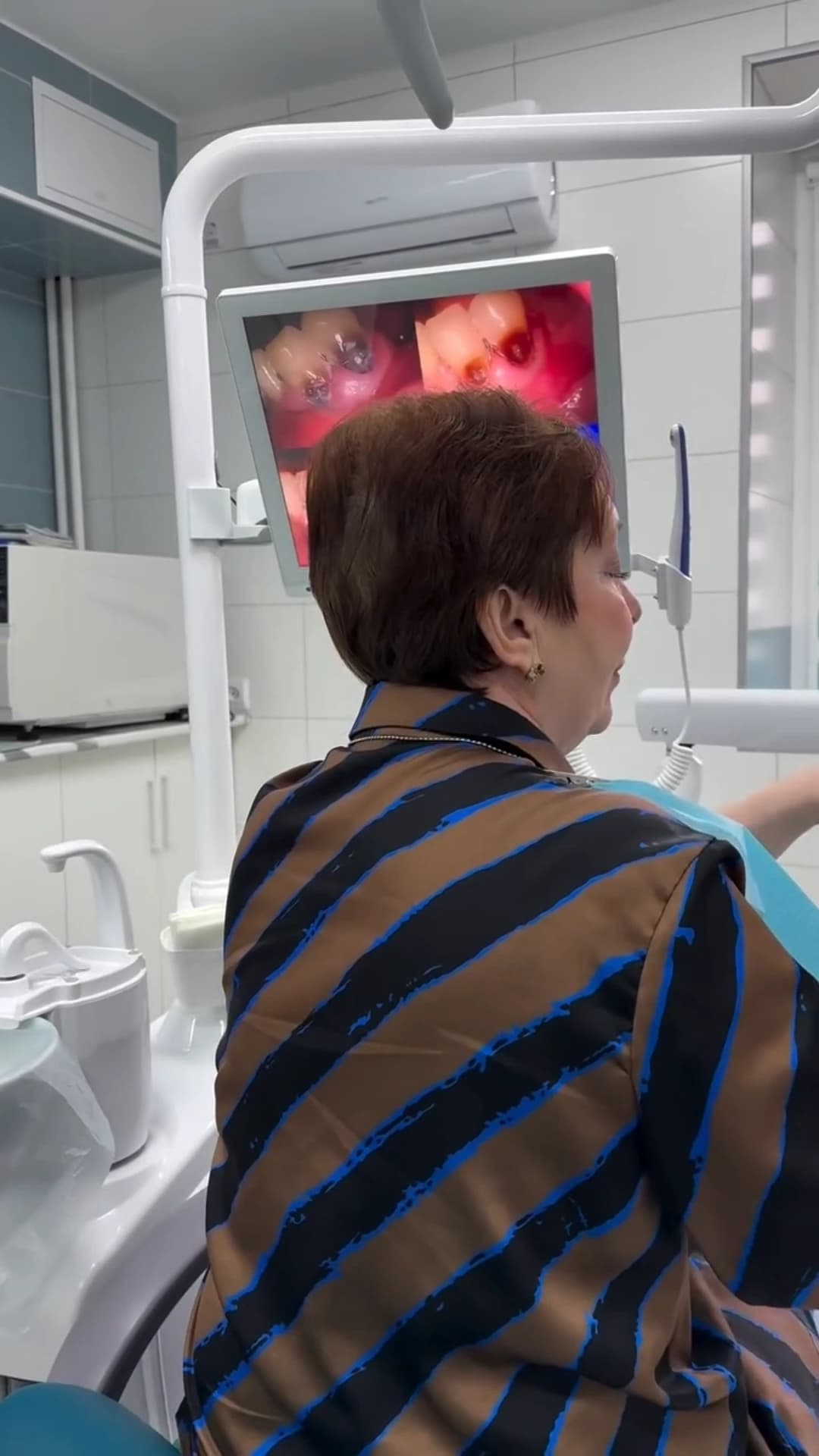 Превью видео